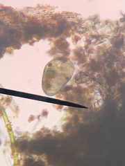 Ostracoda