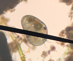 Ostracoda