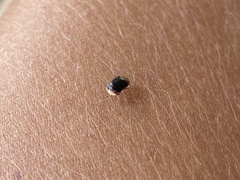 Geocoris erythrocephalus