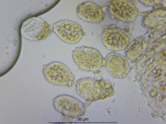 Pucciniastrum epilobii
