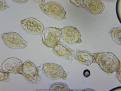 Pucciniastrum epilobii