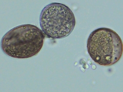 Peronospora belbahrii