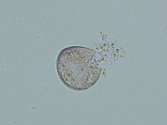 Peronospora belbahrii