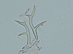 Peronospora belbahrii