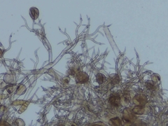 Peronospora belbahrii