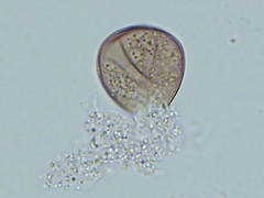 Peronospora belbahrii