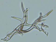 Peronospora belbahrii