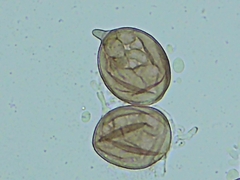 Peronospora belbahrii