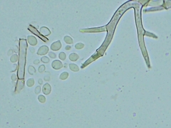 Peronospora belbahrii