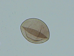 Peronospora belbahrii