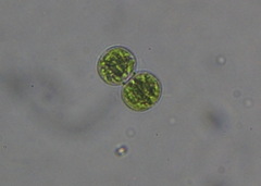 Cosmarium contractum