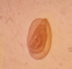 Miliammina obliqua