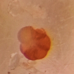 Trochammina inflata