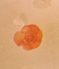 Trochammina inflata
