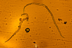 Nematoda