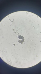 Amoebozoa