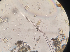 Nematoda