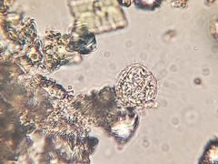 Heliozoa
