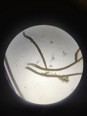 Nematoda
