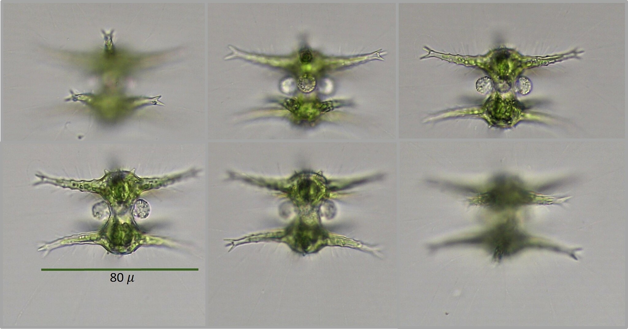 Staurastrum limneticum