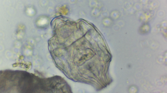 Bdelloidea