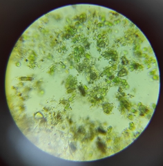 Microcystis