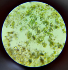 Microcystis