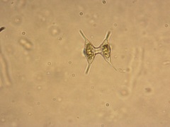 Staurodesmus cuspidatus