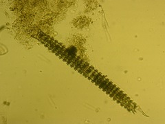 Triploceras verticillatum