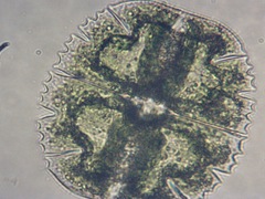 Micrasterias truncata