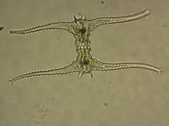 Staurastrum leptocladum