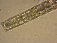 Pleurotaenium verrucosum