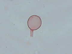 Cystolepiota