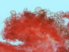 Cystolepiota