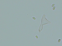 Cystolepiota