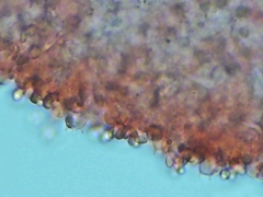 Cystolepiota