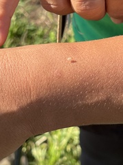 Corythucha marmorata