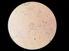 Podosphaera euphorbiae