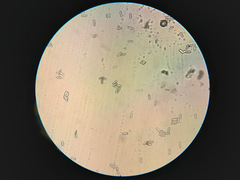 Podosphaera euphorbiae