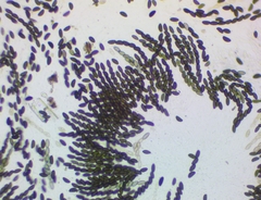 Xylaria corniformis