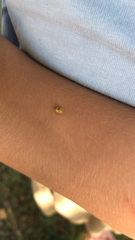 Adalia decempunctata