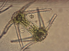 Staurastrum ankyroides