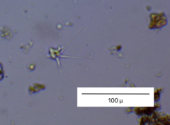 Amoebidae