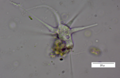Amoebidae