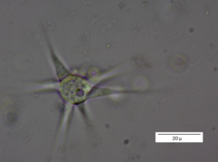 Amoebidae