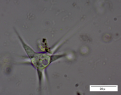 Amoebidae
