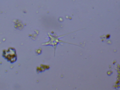Amoebidae