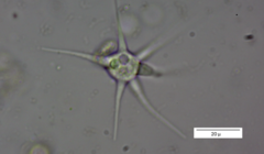 Amoebidae