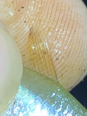 Actinopterygii