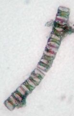 Charophyta